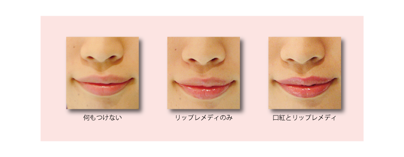 ﾘｯﾌﾟﾚﾒﾃﾞｨ