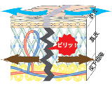 オプティマルと線状斑